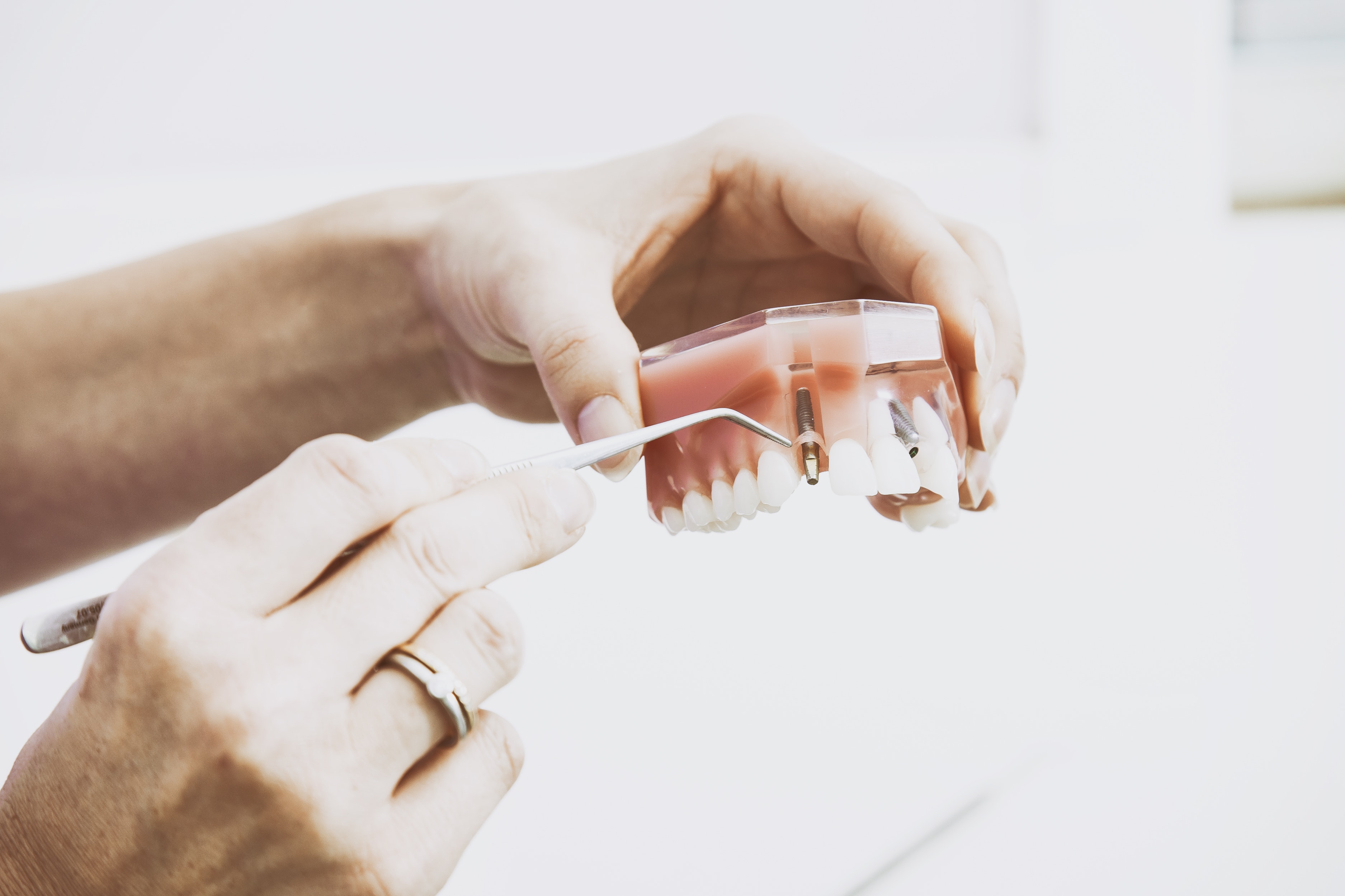hungarydentalimplant